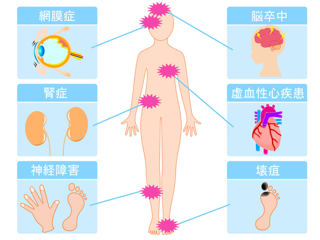 糖尿病